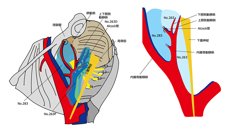 側方リンパ節郭清