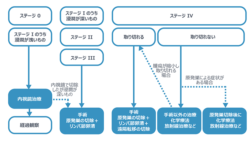 ステージ（病期）と治療のフローチャート