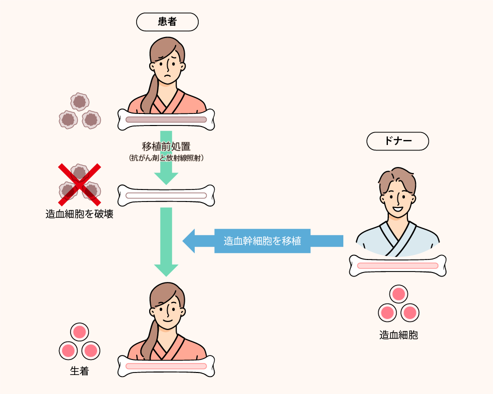 骨髄異形成症候群